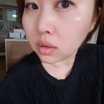 絶望的な毛穴肌の救世主!美容皮膚科×エステの毛穴クレンザーで驚きのうるツヤ肌に!